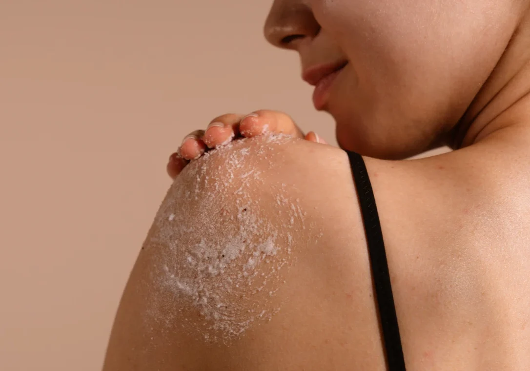 Skin exfoliation on shoulder